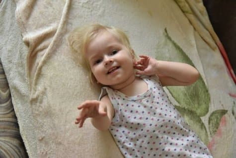 Спинальная мышечная атрофия