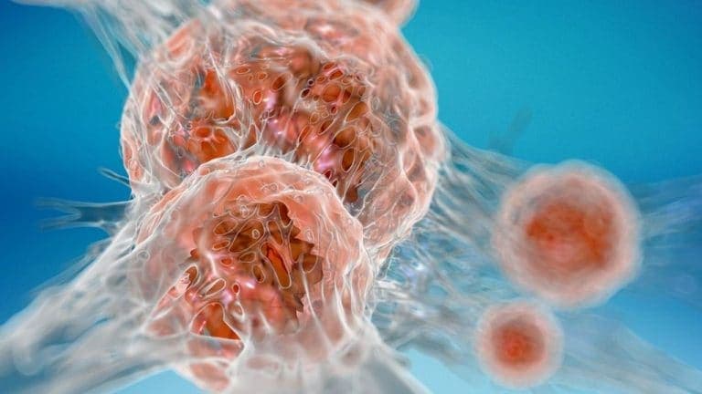 Рак: что это такое и чем опасен?