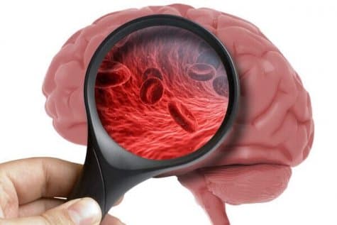 Энцефалопатия