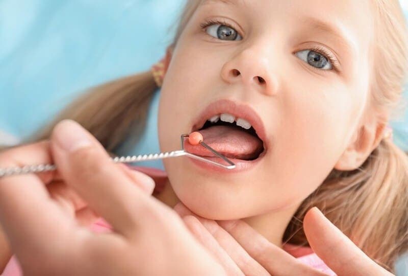 Логопедический массаж