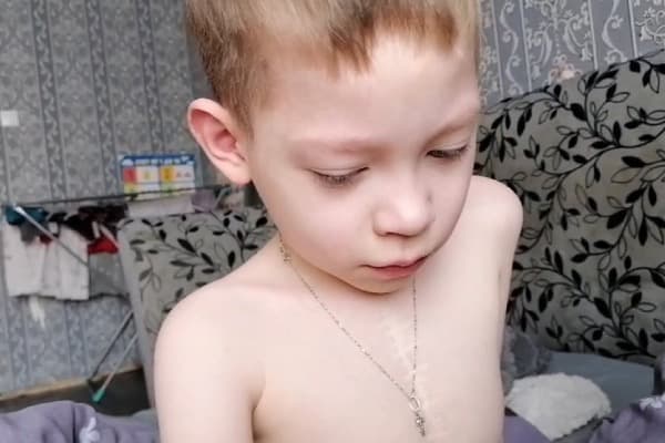 Ефиму трудно дышать. Боремся за жизнь ребенка!